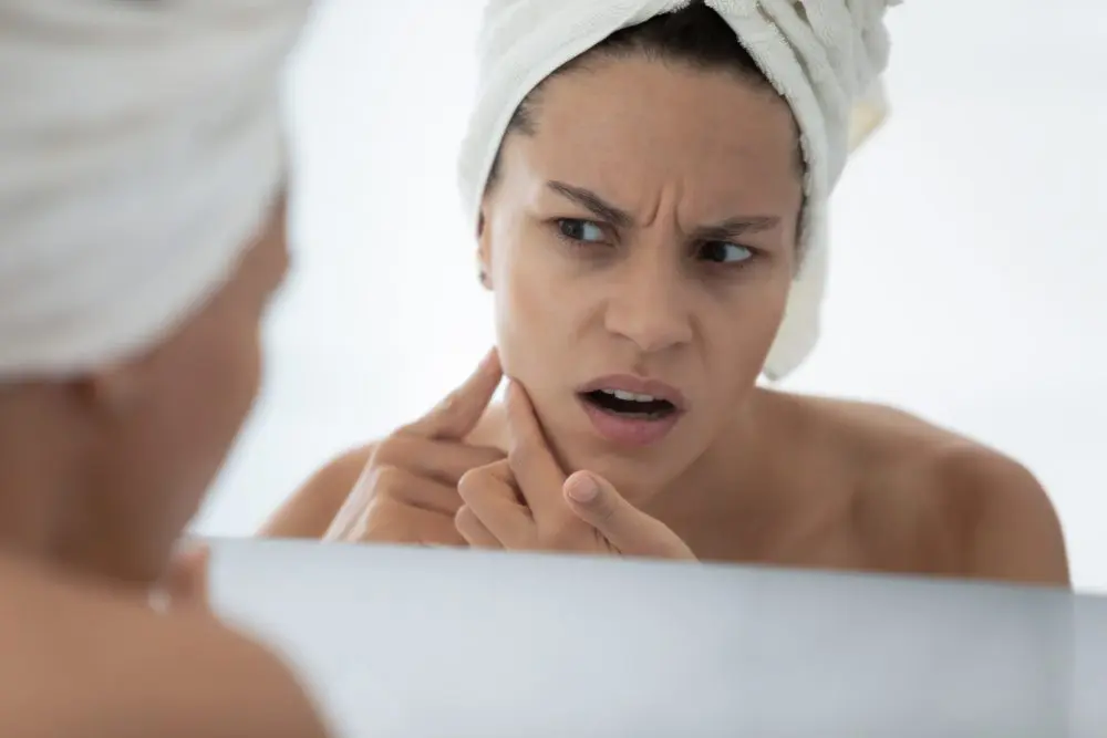 How to Achieve Healthy, Glowing Skin: Skincare Tips for Oily and Acne-Prone Skin Skincare Formulation