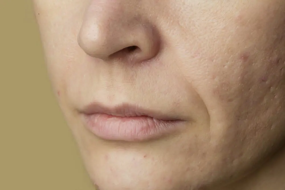 The Benefits of Using Natural Skincare Products For Sensitive Skin: Why You Should Switch to Non-Toxic Beauty Skincare Formulation