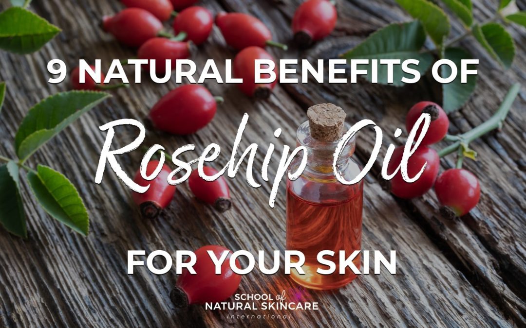 9 Natural Benefits of Rosehip Oil for Your Skin